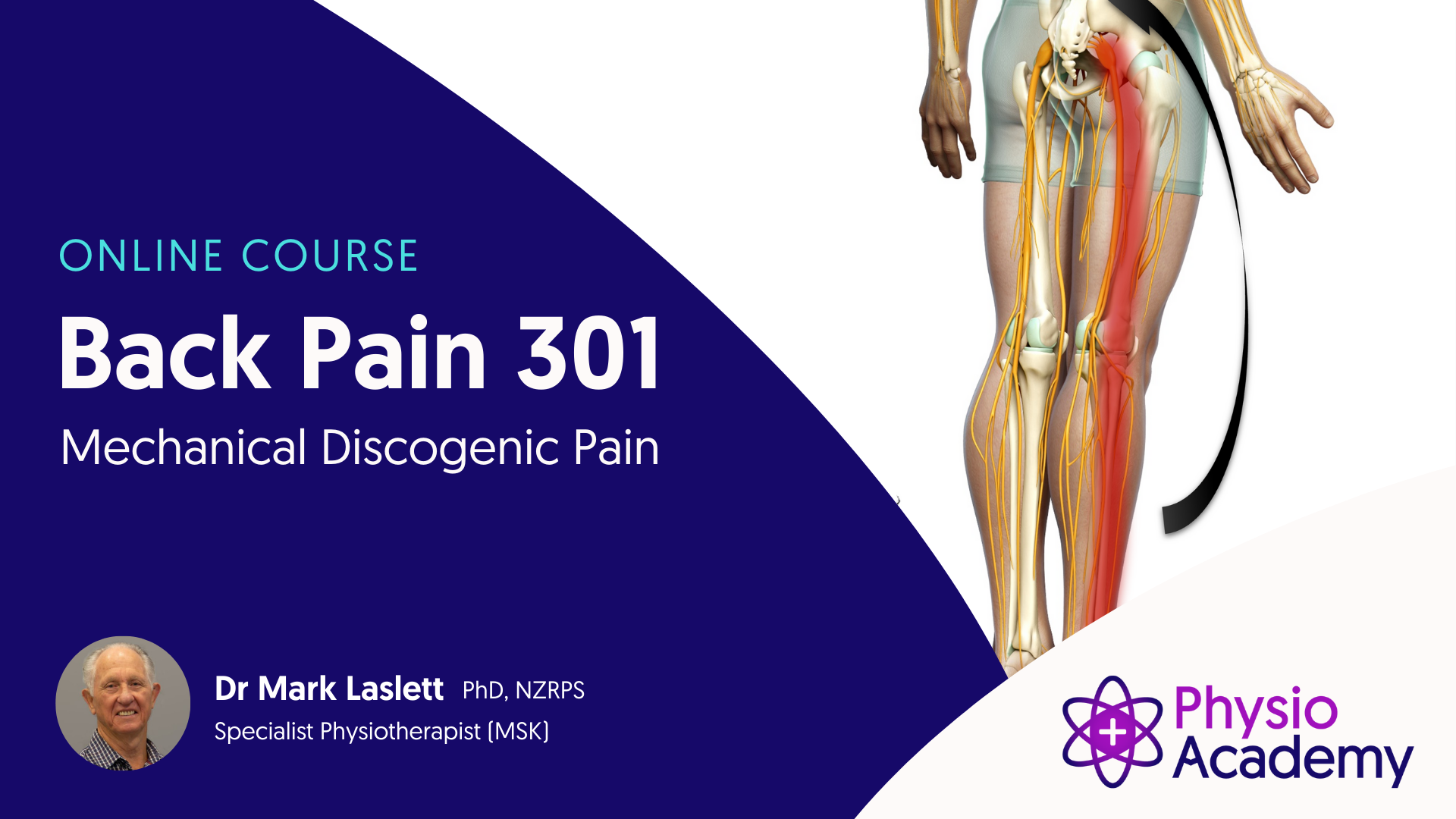 Physio Academy Back Pain Mechanical Discogenic Pain Key