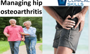 Cover for managing hip osteoarthritis physiotherapy course