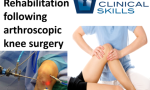 Cover for rehabilitation following arthroscopic knee surgery physiotherapy course