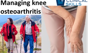 Cover for managing knee osteoarthritis physiotherapy course