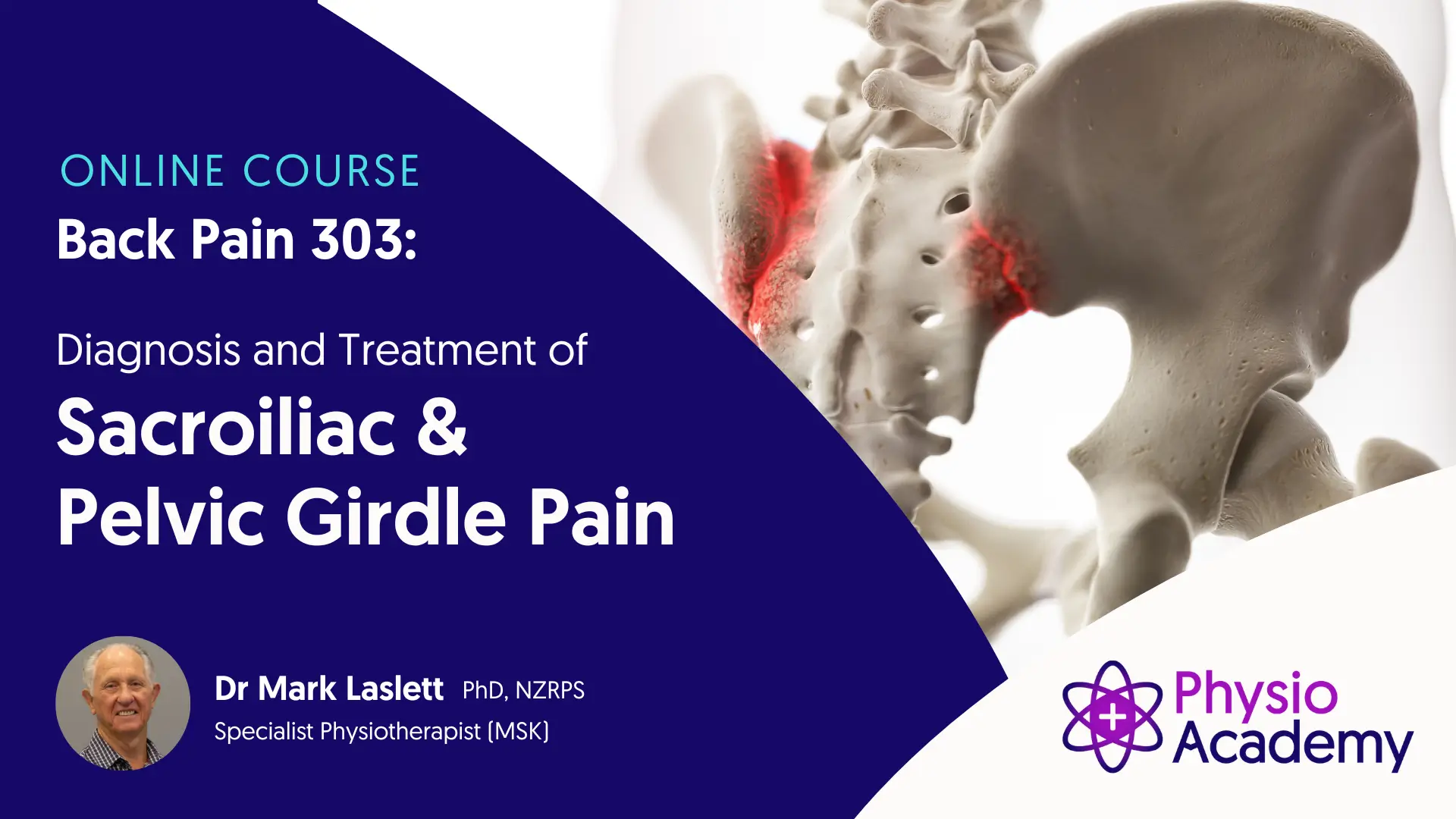 Cover for Physio Academy Back Pain 303 Diagnosis & Treatment of Sacroiliac & Pelvic Girdle Pain physiotherapy course